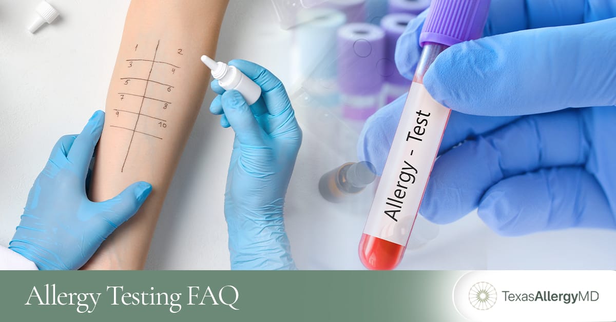 Allergy testing common questions and answers.