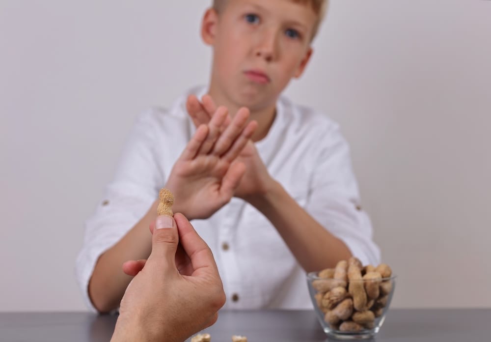 Peanut allergy early warning signs & symptoms in children.