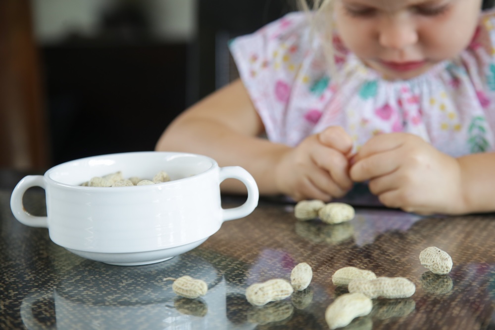 Child undergoing peanut allergy testing.